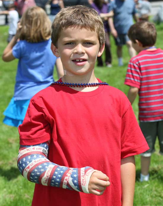 Jack Armstrong's broken arm sports a patriotic cast.
