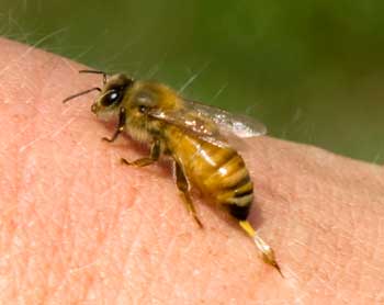 Loree Burns gets stung on the arm by a honey bee. (Photo by Ellen Harasimowicz)